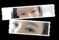 是二次手術呢,,,