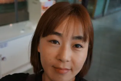 老公說我現在的樣子就很漂亮，所以反對我動手術⋯