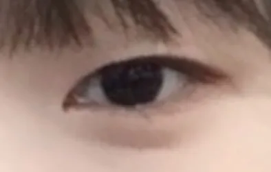 超級喜歡這次手術^^