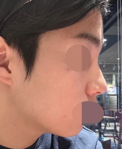 現在過了三個月左右，對形狀非常滿意。