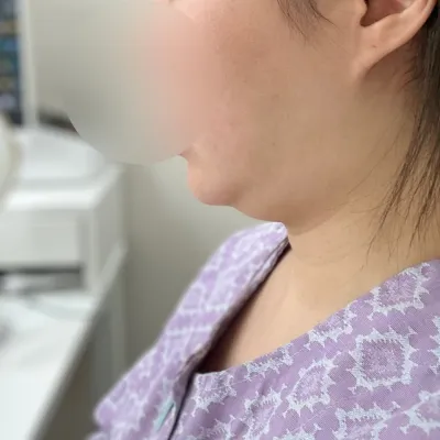 俐落的下顎線條真的非常非常棒。