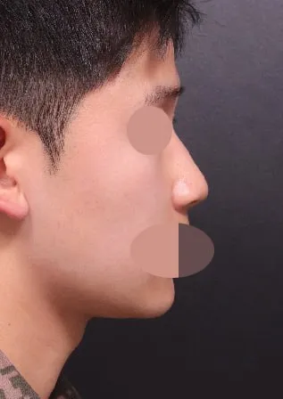 我想我可以自信地推薦 Very Good 整形外科。