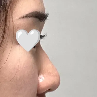 感覺幫我做出了很適合我臉型的線條。