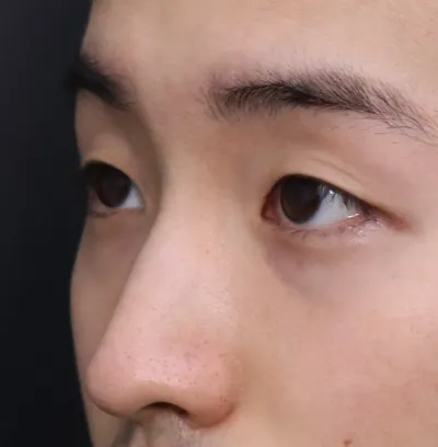 滿意度最高，建議去諮詢看看，真心大推。