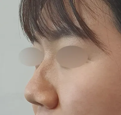 我的第二位父親金容佑院長、南在成院長！！！謝謝您們幫我手術做得這麼漂亮！♥♥