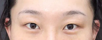 如果之後還要再做其他部位的話，我想我會先來 Very Good 整形外科。強推！！