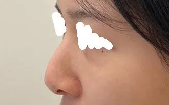 為什麼不早點做呢ㅠㅠ 早點變美就好了ㅜㅜ