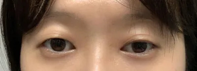 但結果真的太好了，還是推薦給大家！！