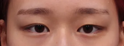 醫院內部很整潔，大家也都很親切，讓我可以毫無負擔地完成從諮詢、手術到術後管理的整個過程。