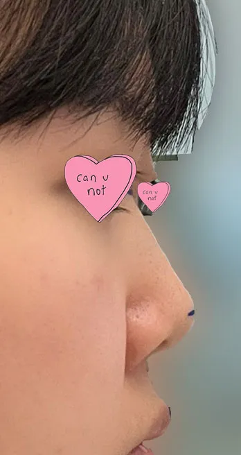 覺得相信林榮敏院長並接受手術是正確的決定，非常推薦！