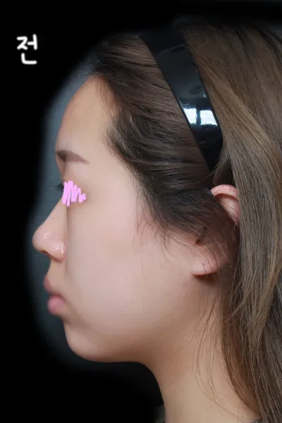 大家都在問是哪間醫院 哈哈 謝謝 ❤