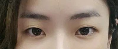 既清晰又非常自然，甚至讓我懷疑當初為什麼會考慮切開法！