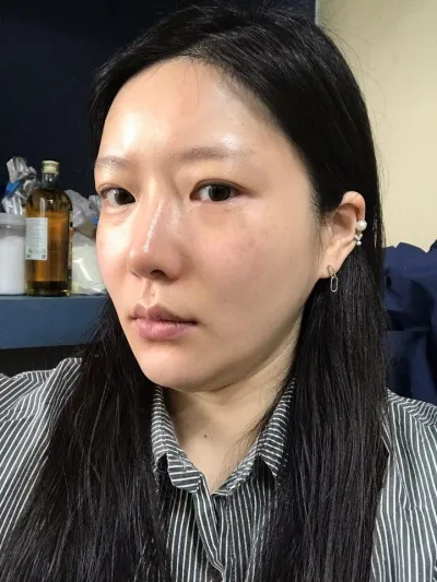 雖然已經過了30歲，但提拉效果對於被說顯年輕似乎非常顯著。呵