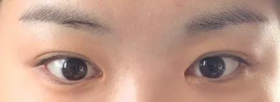 Very Good 是雙眼皮名店，還在猶豫的人趕快來訪吧！