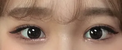 在 Very Good 整形外科做了自然黏連、開內眼角！