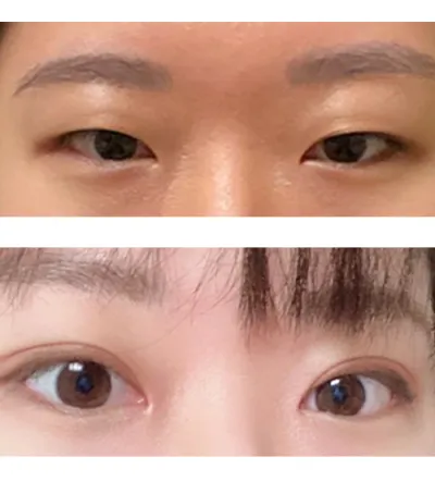 強烈推薦 Very Good 整形外科 ^ㅡ^