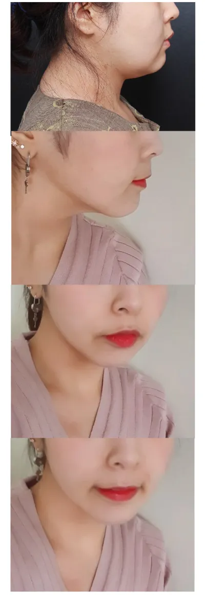 今後我也會好好保養的唷！！謝謝院長！！