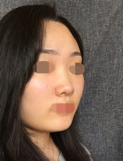 院長非常客觀地指出需要改進的地方，當我詢問設計方面的問題時，他也事先說明了不可能的部分，這種坦誠的諮詢讓我感覺更棒。