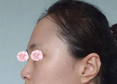 室長和院長都非常親切，鼻樑和鼻尖我也都很滿意！！