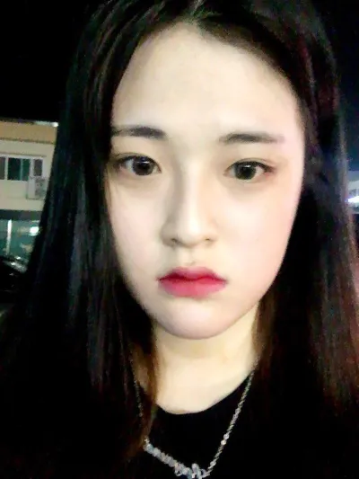 我太開心了~~~ 術後已經6個月了，現在真的到了大多數人都看不出我有動過手術的程度了~