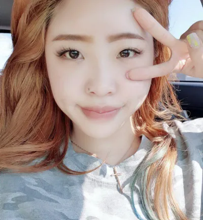 手術完三個月了！感覺腫都消得差不多了。