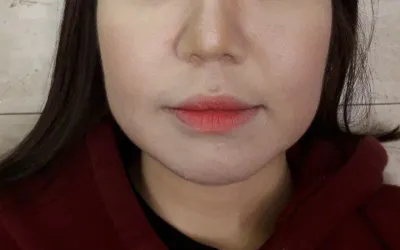 非常感謝金俊賢院長，提供了快速的諮詢、明快的方案以及令人滿意的施作結果！