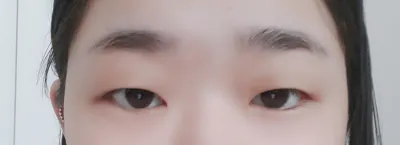 眼睛變大了很多，超級滿意！！