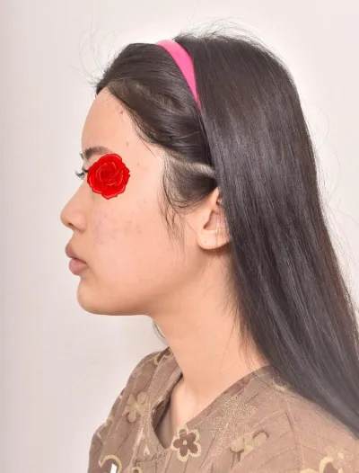 很滿意！！謝謝林永民院長！！