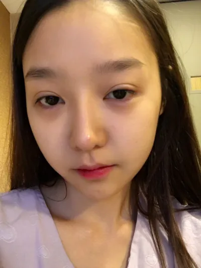 不要再為重修手術煩惱了，就在 Very Good 做吧～