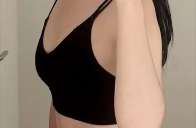 魔滴滿一個月心得）週五手術，週一上班！