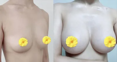 魔滴 6個月) 果然選擇 Melon 沒有後悔❤️