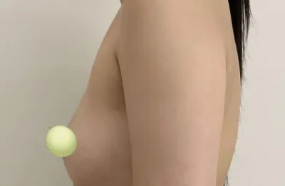 我的疤痕最小，也看不見 哈哈