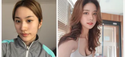 眼睛、鼻子、面部輪廓、全臉脂肪移植、嘴唇填充