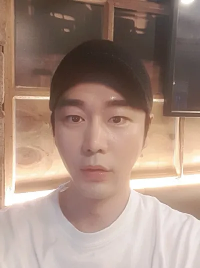 我做了埋線拉提和額頭脂肪移植~