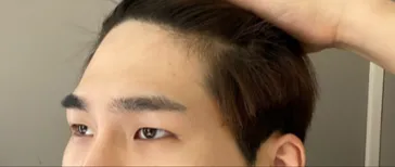 做了眼型矯正和額頭拉提的'5個月後記！