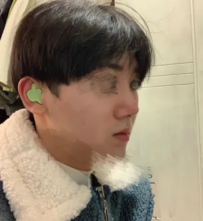 鼻部重修手術（鼻樑、鼻尖）、鼻翼縮小