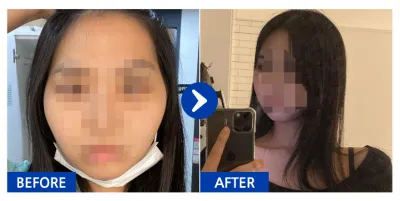 [Babitalk] 臉部輪廓 / 1個月 / 暱稱：다라뮈