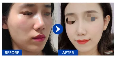 [Babytalk] 臉部輪廓 / 第3個月 / 暱稱：dbdbdlaa