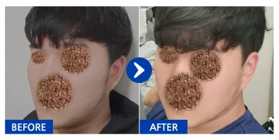 [Babitalk] 臉部輪廓 / 第3個月 / 暱稱：安能雄