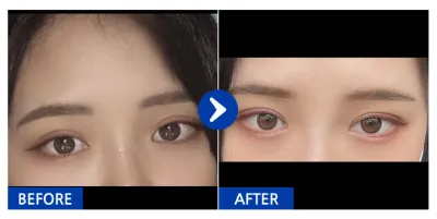 [江南姐姐] 自然黏連 / 1個月 / 暱稱：띠용ㅇㅅㅇ