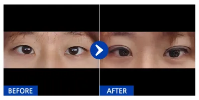 [江南姐姐] 自然黏連 / 1個月 / 暱稱：ㅋㄱㅋㅋㄲ