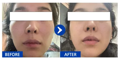 [江南姐姐] 顴骨 / 1個月 / 暱稱：Meaning Made