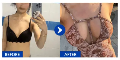 [Babytalk 心得] 胸部 (曼陀光滑面) / 第3個月 / 暱稱：黑色小貓k