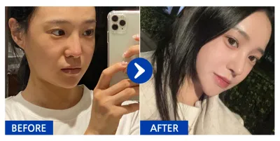 [Babitalk] 隆鼻 / 第1週 / 暱稱：短尾矮袋鼠u0VdN