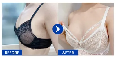 [江南姐姐] 隆乳 (賽彬 Sublimity) / 1個月 / 暱稱：째유유