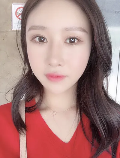 [眼部] JW整形 - 眼、鼻