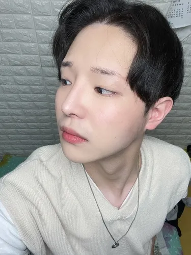 [男生] Hyukseu - 切開式眼瞼下垂矯正、開眼頭、隆鼻