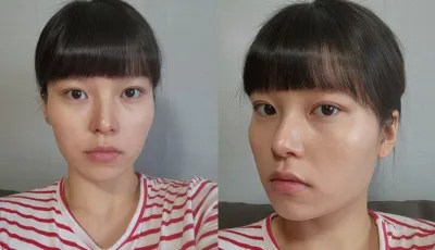 [顏面輪廓] 뇸뇸씨 - 顏面輪廓