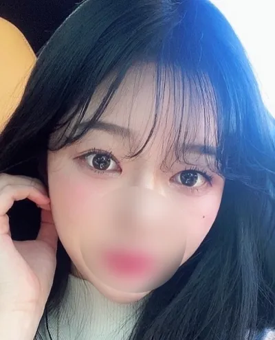 [眼部] 뽀모도로 - 切開雙眼皮（重修手術）