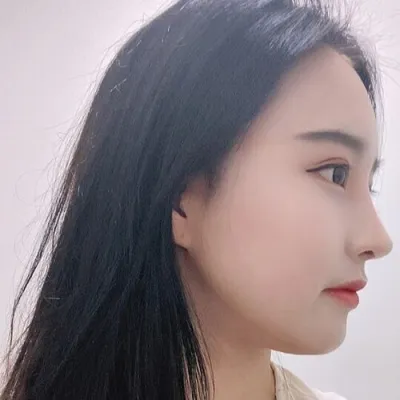 [鼻] 冬季真好 - 鼻樑鼻尖截骨